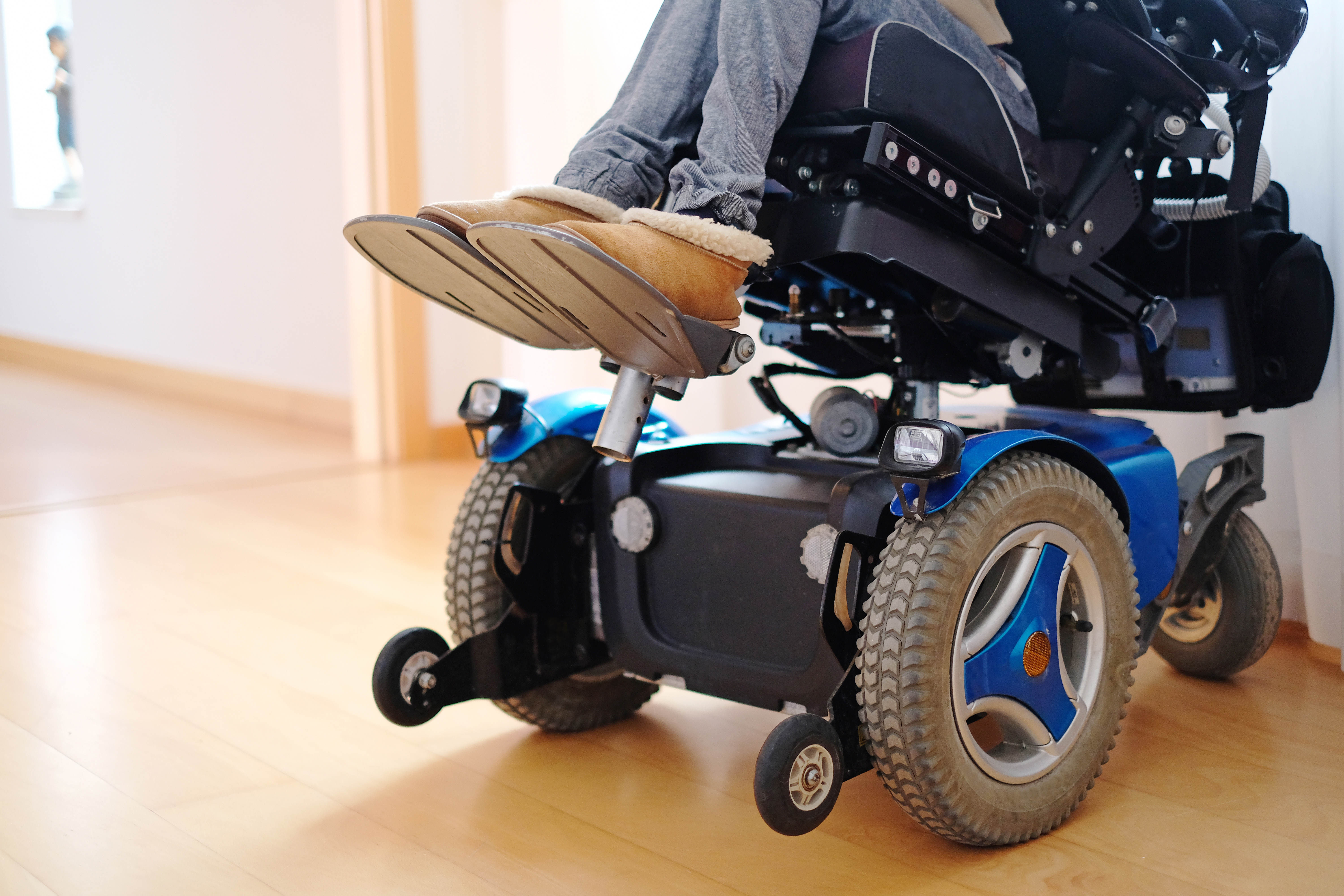 Woman sitting in a blue electric wheelchair.