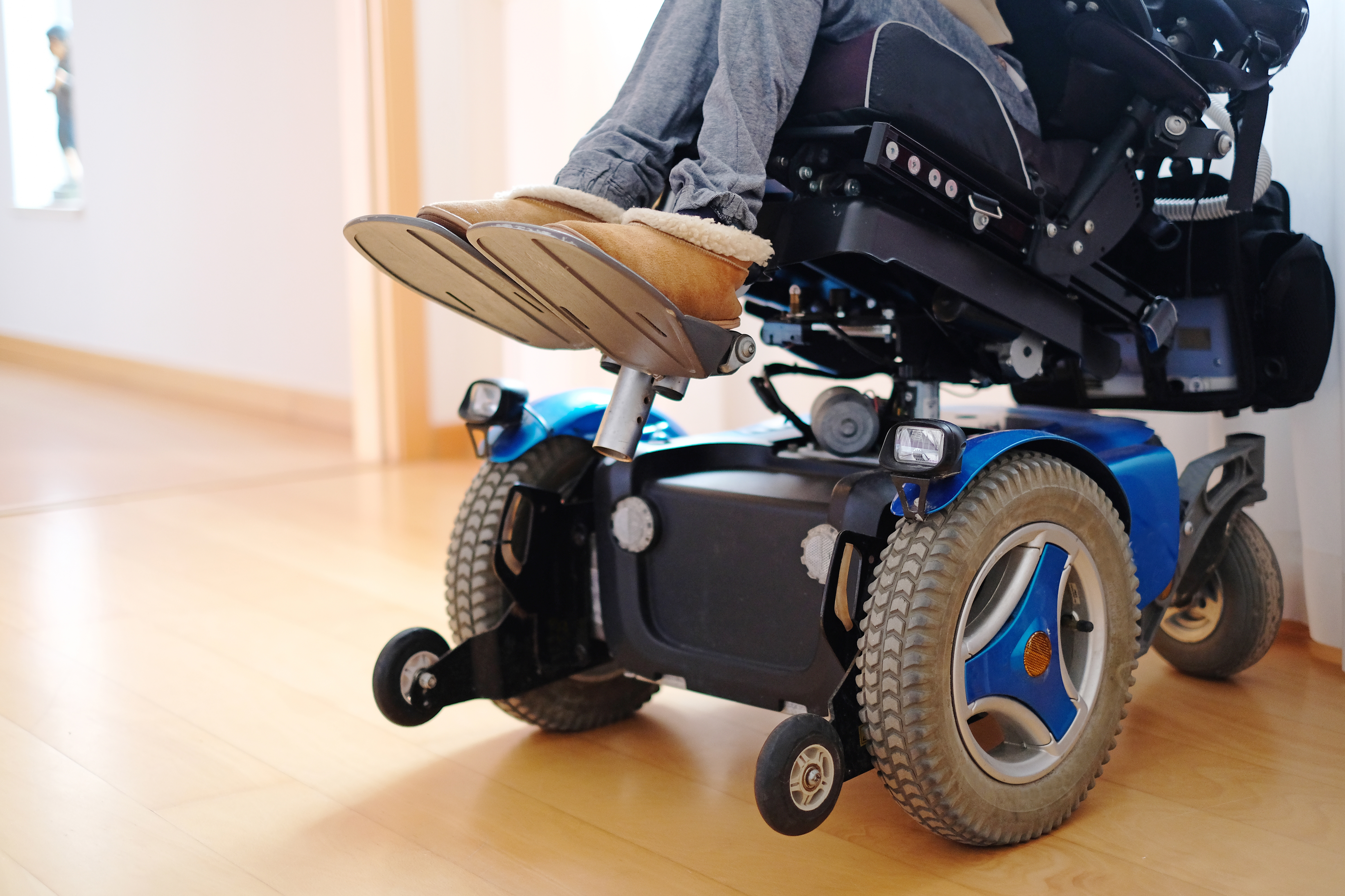 Woman sitting in a blue electric wheelchair. 